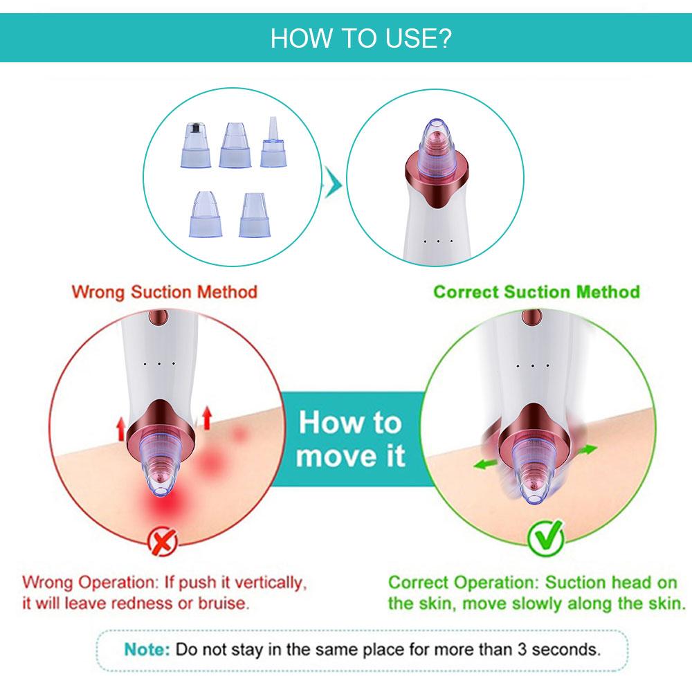 Sonic Pore Rejuvenator - Pore Blackhead Remover | Realm Concept Market - Realm Concept Market